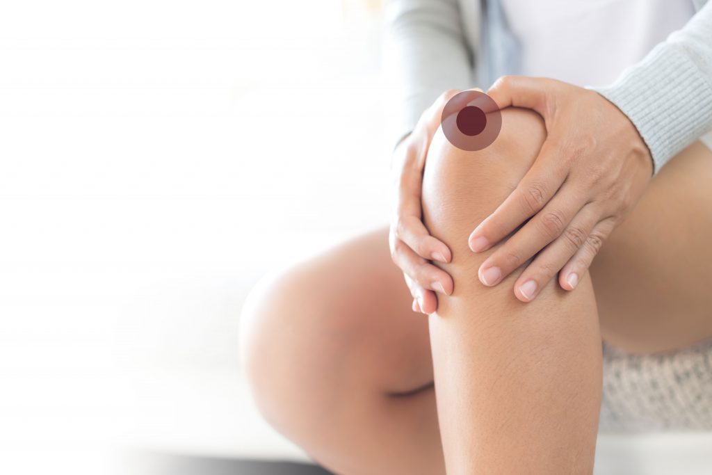 Qu'est-ce que l'arthrose du genou ?